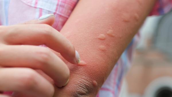 Rohit Lakhwani, zoólogo: “Los mosquitos ya muestran las primeras señales de resistencia a los insecticidas” - Los científicos descubren cómo los mosquitos están empezando a defenderse