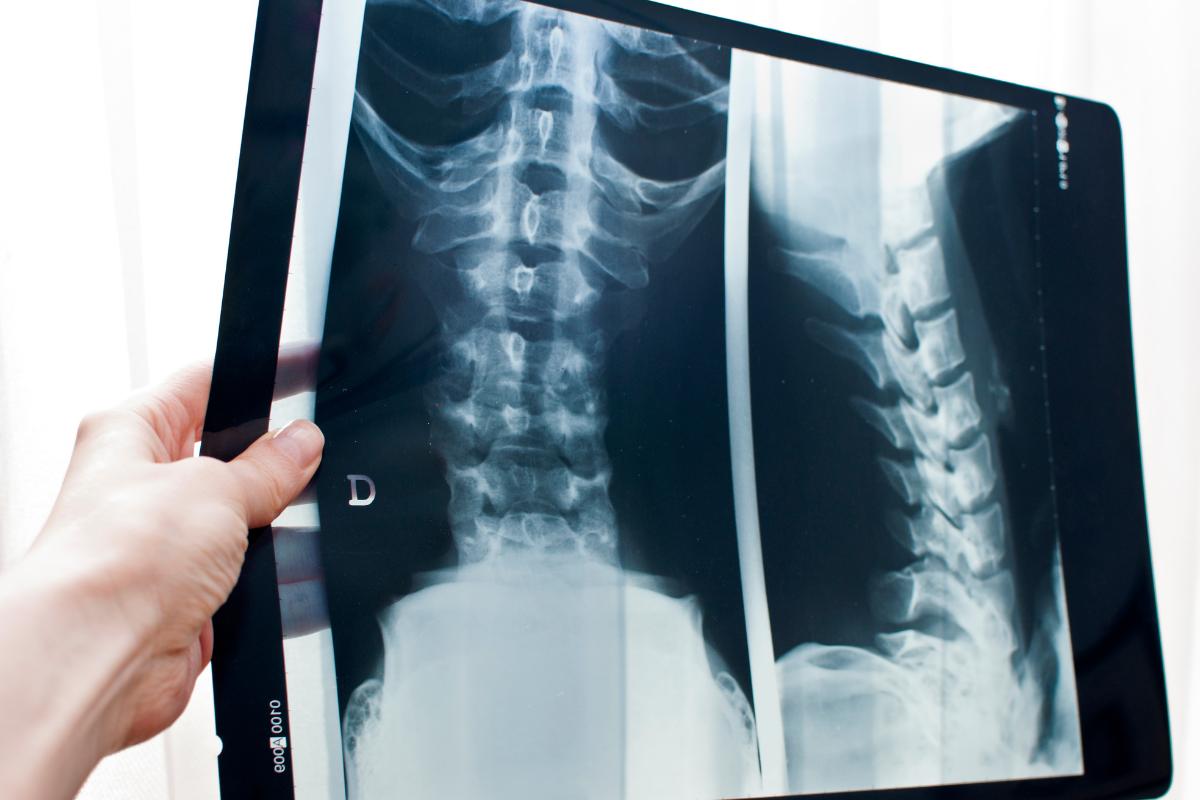 Dónde se tiran las radiografías