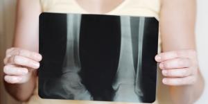 Dónde tirar radiografías viejas