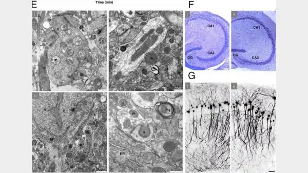 Científicos logran revivir la actividad en el cerebro de un ratón congelado a −196 °C por primera vez - El momento decisivo: cuando el cerebro vuelve a transmitir señales