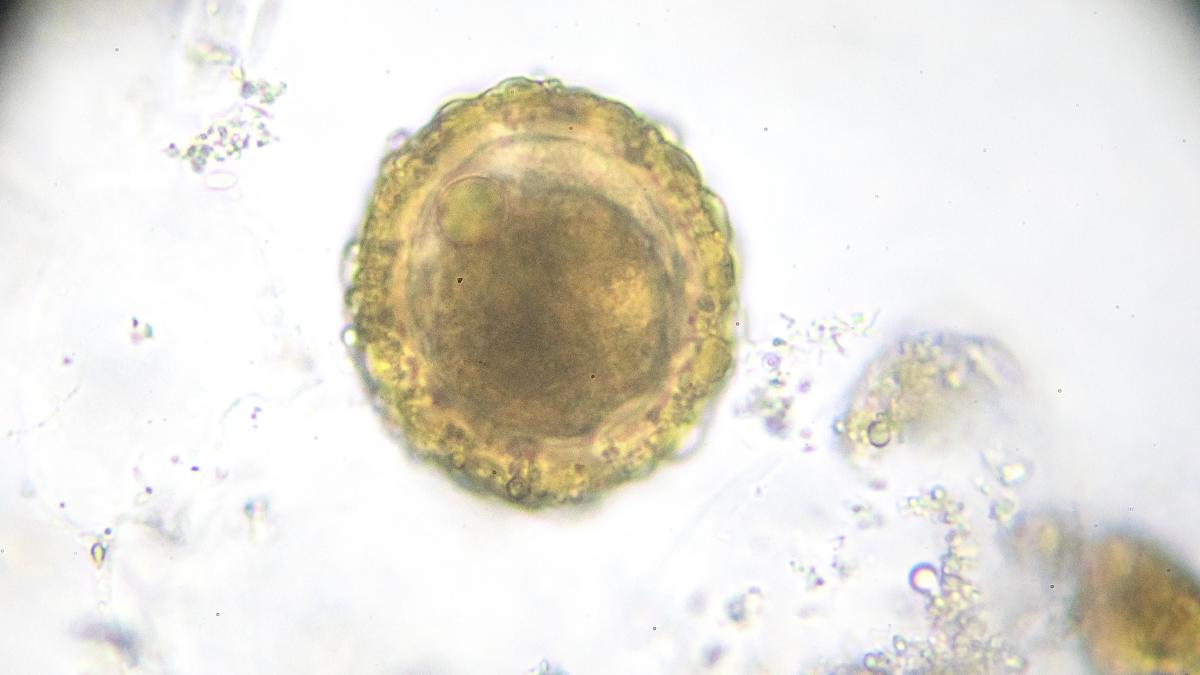 ¿Cuál es la célula más grande del cuerpo humano?