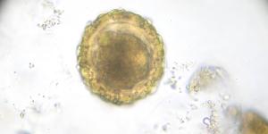 ¿Cuál es la célula más grande del cuerpo humano?