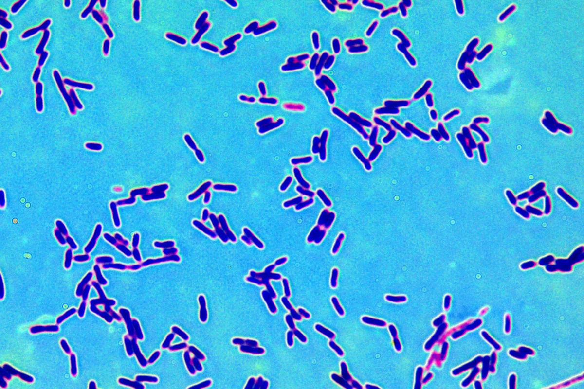 Bacterias halófilas: ejemplos y características