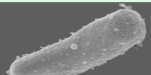 Arqueas: qué son, ejemplos y diferencia con las bacterias