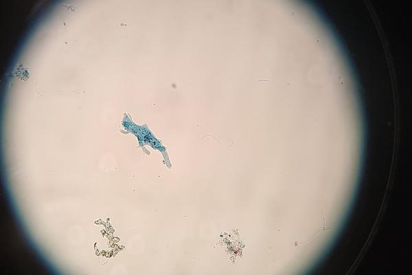 Arqueas: qué son, ejemplos y diferencia con las bacterias - Ejemplos de arqueas