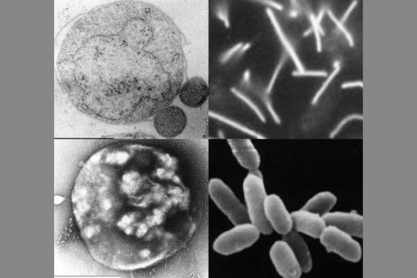 Arqueas: qué son, ejemplos y diferencia con las bacterias - Tipos de arqueas