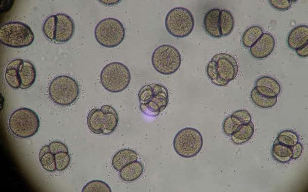 Las 4 fases de la Mitosis - ¿En qué beneficia la mitosis?