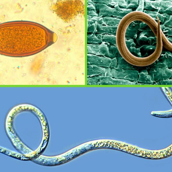 gusanos nematodos en humanos