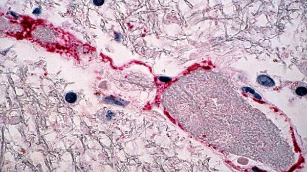 Qué es el virus Nipah: el patógeno sin vacuna que mantiene en alerta a India - Un virus raro, pero muy peligroso