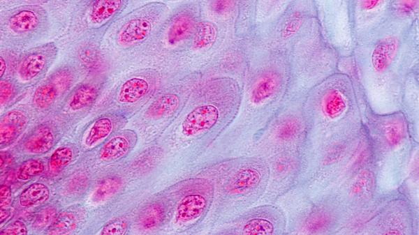Desmosomas: qué son, función y estructura - ¿Cuál es la función de los desmosomas? 