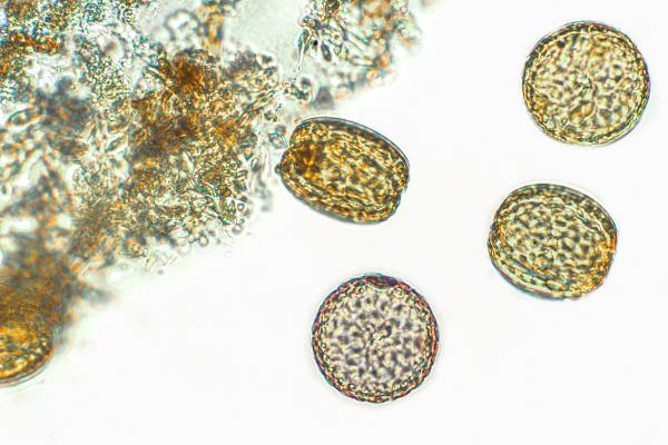 Algas diatomeas: qué son, características y para qué sirven - ¿Cuáles son las partes de una diatomea?