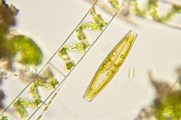 Algas diatomeas: qué son, características y para qué sirven - ¿Cuáles son los tipos de diatomeas que existen?