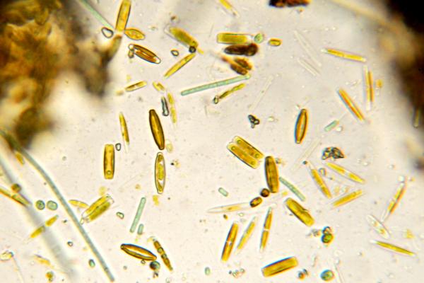 Algas diatomeas: qué son, características y para qué sirven - ¿Qué son las algas diatomeas?