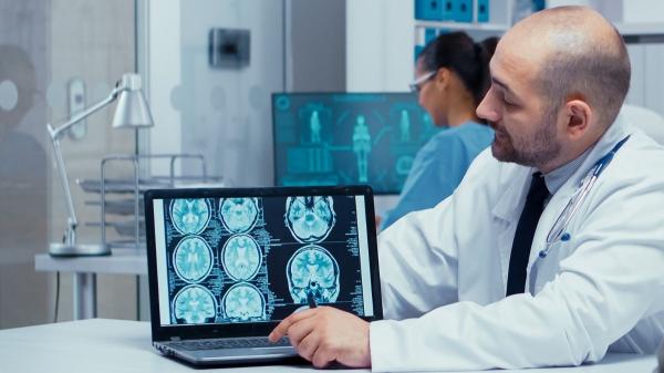 Investigadores catalanes logran revertir el Alzheimer en ratones en tiempo récord - La clave está en los vasos sanguíneos del cerebro