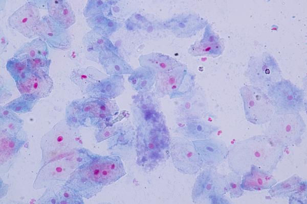 Células epiteliales: qué son, funciones y tipos - Qué son las células epiteliales