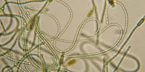 Cianobacterias: qué son, características, tipos y ejemplos