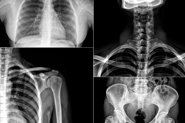 Energía electromagnética: qué es, características, ejemplos y para qué sirve - ¿Qué ejemplos de energía electromagnética existen?
